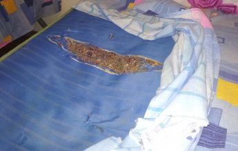 Murdărie, gândaci și saltele mizerabile. În ce condiții sunt cazați elevii în două internate din Turnu Măgurele
