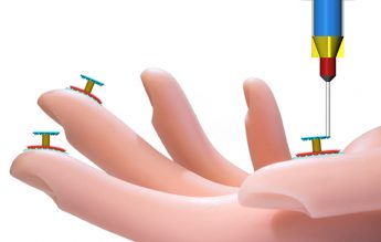 10 mai 2017: „Pielea bionică” este creată