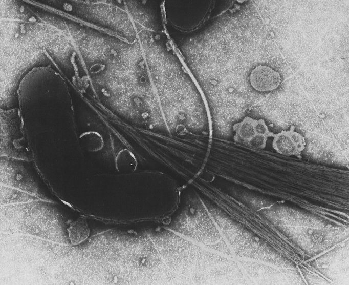 bacteria care cauzeaza holera