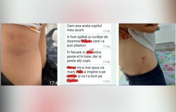 Elevi ajunși acasă cu vânătăi pe corp. Părinții au sesizat școala, directoarea îi ignoră: „Nu au trecut 30 de zile”