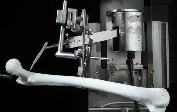 7 noiembrie 1992: Prima proteză de șold realizată de un robot (ROBODOC)