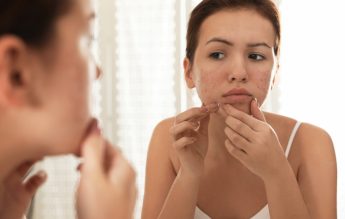 Acneea la adolescenți: Trei etape pentru rutina de îngrijire a pielii, recomandate de medici
