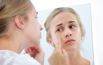 Acneea la adolescenți și la adulți. Sfaturi de la Dr. Alin Nicolescu, medic primar dermatologie