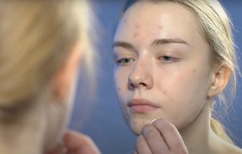 Ce riscăm dacă ne curățăm tenul acneic acasă, fără consultarea unui specialist dermatolog