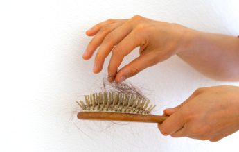 Ce este ALOPECIA ANDROGENICĂ?